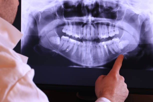 Best Dentist for Tooth Abscess  in Green Oaks, IL