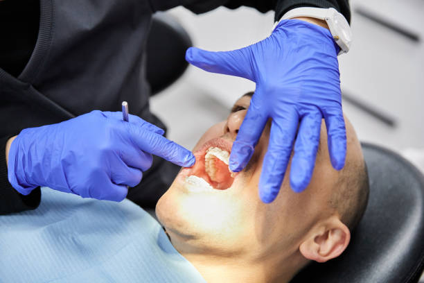 Best Knocked-Out Tooth Emergency  in Green Oaks, IL